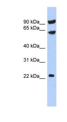 Western Blot: TIGD3 Antibody [NBP1-70725]
