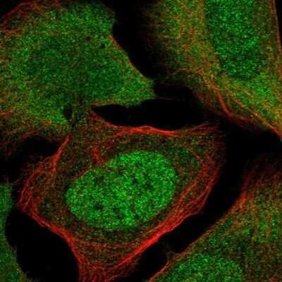 Immunocytochemistry/ Immunofluorescence: TIGD4 Antibody [NBP1-86303]