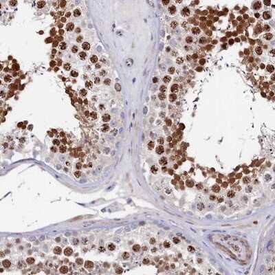 Immunohistochemistry-Paraffin: TIGD4 Antibody [NBP1-86303]