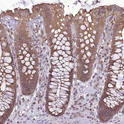 Immunohistochemistry: TIGD7 Antibody [NBP1-80790]
