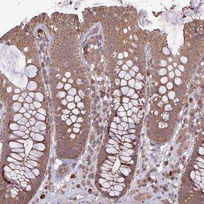 Immunohistochemistry: TIGD7 Antibody [NBP1-80791]