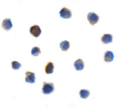 Immunocytochemistry/ Immunofluorescence: TIGIT Antibody (2B5) - VHH - Azide and BSA Free [NBP3-12831]