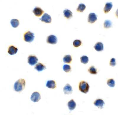 Immunocytochemistry/ Immunofluorescence: TIGIT Antibody (2C6) - VHH - Azide and BSA Free [NBP3-12833]