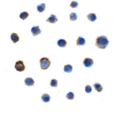 Immunocytochemistry/ Immunofluorescence: TIGIT Antibody (2C7) - VHH - Azide and BSA Free [NBP3-12834]