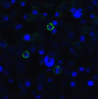 Immunocytochemistry/ Immunofluorescence: TIGIT Antibody (2D7) - VHH - Azide and BSA Free [NBP3-12835]