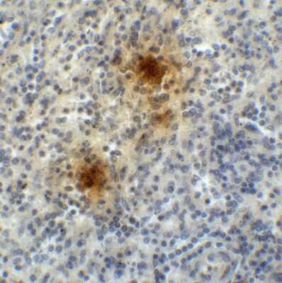 Immunohistochemistry: TIGIT Antibody (2D7) - VHH - Azide and BSA Free [NBP3-12835]