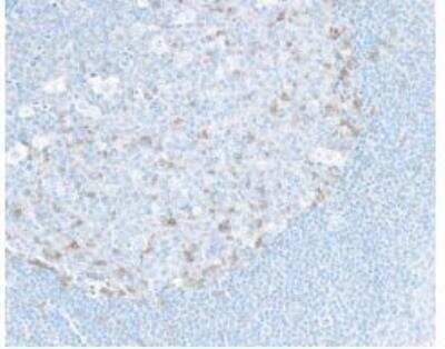 Immunohistochemistry: TIGIT Antibody (BLR047F) [NBP3-14674]