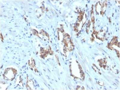 Immunohistochemistry-Paraffin: TIGIT Antibody (TIGIT/3106) - Azide and BSA Free [NBP2-79928]
