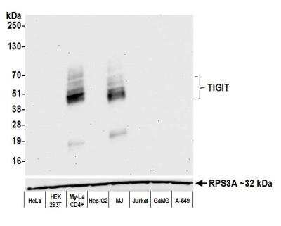 Western Blot: TIGIT Antibody (BLR047F) [NBP3-14674]