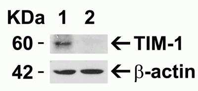 Western Blot: TIM-1/KIM-1/HAVCR AntibodyBSA Free [NBP1-76701]