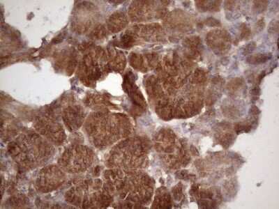 Immunohistochemistry: TIM-3 Antibody (OTI2E2) [NBP2-45933]
