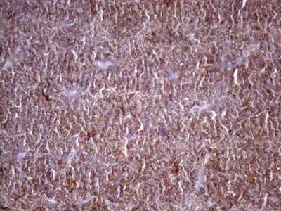 Immunohistochemistry: TIM-3 Antibody (OTI2E2) [NBP2-45933]