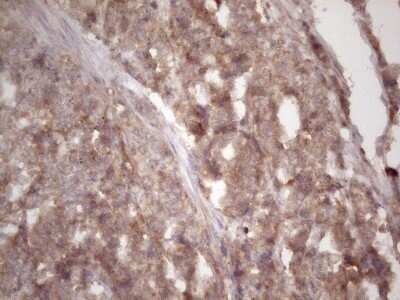 Immunohistochemistry: TIM-3 Antibody (OTI2E2) - Azide and BSA Free [NBP2-74520]