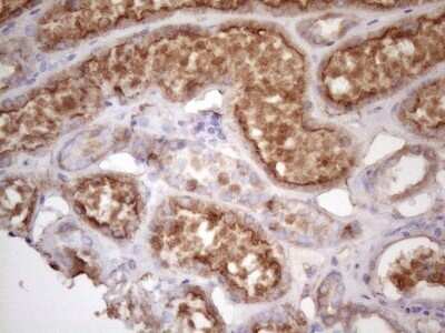 Immunohistochemistry: TIM-3 Antibody (OTI2E2) - Azide and BSA Free [NBP2-74520]