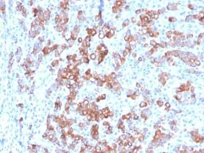 Immunohistochemistry-Paraffin: TIM-3 Antibody (TIM3/3113) - Azide and BSA Free [NBP2-79836]