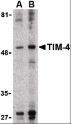 Western Blot: TIM-4 AntibodyBSA Free [NB100-80837]