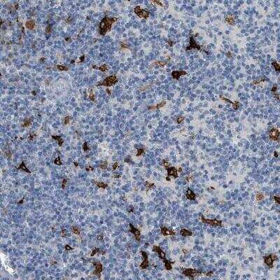 Immunohistochemistry-Paraffin: TIM-4 Antibody [NBP1-87569]