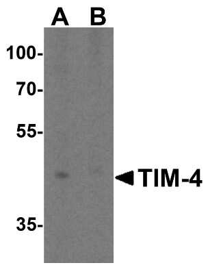 Western Blot: TIM-4 AntibodyBSA Free [NBP1-76702]