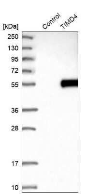 Western Blot: TIM-4 Antibody [NBP1-87569]