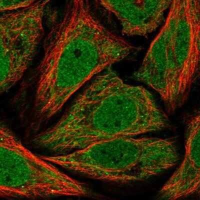 Immunocytochemistry/ Immunofluorescence: TIMM17A Antibody [NBP1-80681]