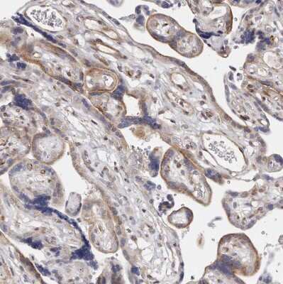Immunohistochemistry-Paraffin: TIMM17B Antibody [NBP1-84036]