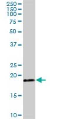 Western Blot: TIMM22 Antibody [H00029928-B01P]