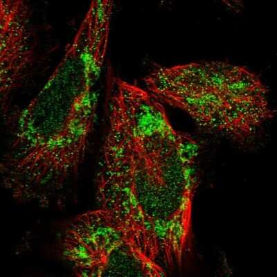 Immunocytochemistry/ Immunofluorescence: TIMM29 Antibody [NBP1-94151]