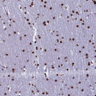 Immunohistochemistry-Paraffin: TIMM29 Antibody [NBP1-94151]
