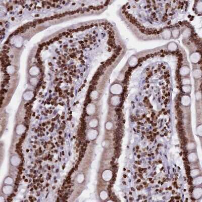 Immunohistochemistry-Paraffin: TIMM29 Antibody [NBP1-94151]