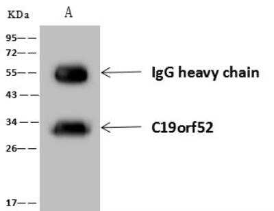 Immunoprecipitation: TIMM29 Antibody [NBP3-12622]