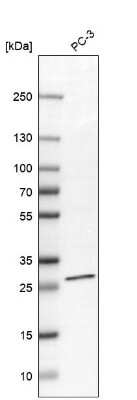 Western Blot: TIMM29 Antibody [NBP1-94151]