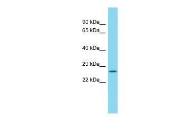 Western Blot: TIMM29 Antibody [NBP2-83653]