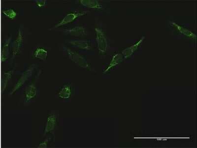 Immunocytochemistry/ Immunofluorescence: TIMM44 Antibody [H00010469-B01P]