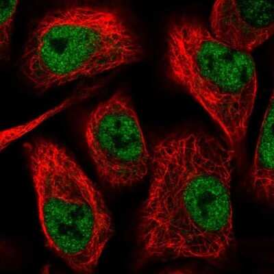 Immunocytochemistry/ Immunofluorescence: TIMM50 Antibody [NBP2-38791]