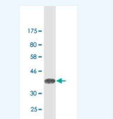 Western Blot: TIMM8A Antibody (2D12) [H00001678-M02]