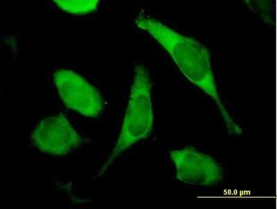 Immunocytochemistry/ Immunofluorescence: TIMM8A Antibody [H00001678-B01P]