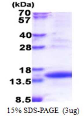 SDS-PAGE: Recombinant Human TIMM8A His Protein [NBP2-22882]