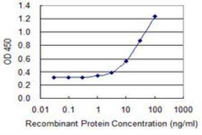 ELISA: TIMM8B Antibody (8E5) [H00026521-M15]