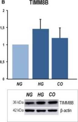 Western Blot: TIMM8B Antibody (8E5) [H00026521-M15]