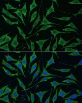 Immunocytochemistry/ Immunofluorescence: TIMM8B Antibody - Azide and BSA Free [NBP2-94190]