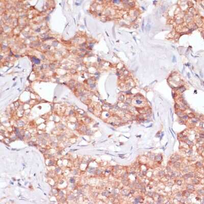 Immunohistochemistry-Paraffin: TIMM8B Antibody - Azide and BSA Free [NBP2-94190]