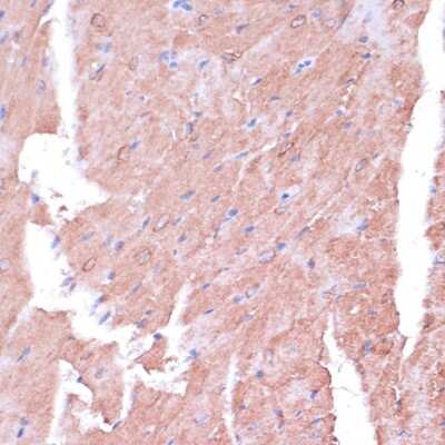 Immunohistochemistry-Paraffin: TIMM8B Antibody - Azide and BSA Free [NBP2-94190]