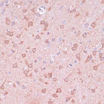 Immunohistochemistry-Paraffin: TIMM8B Antibody - Azide and BSA Free [NBP2-94190]