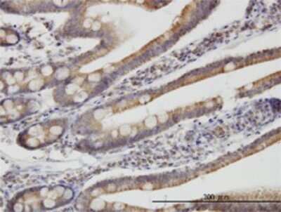 Immunohistochemistry-Paraffin: TIMM9 Antibody (1D6) [H00026520-M01]