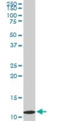 Western Blot: TIMM9 Antibody (1D6) [H00026520-M01]