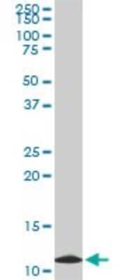 Western Blot: TIMM9 Antibody (1D6) [H00026520-M01]