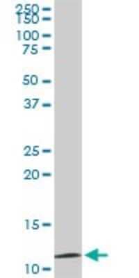 Western Blot: TIMM9 Antibody (1D6) [H00026520-M01]