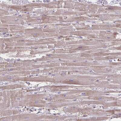 Immunohistochemistry: TIMMDC1 Antibody [NBP2-38773]