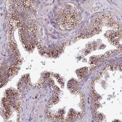 Immunohistochemistry-Paraffin: TIMMDC1 Antibody [NBP2-13433]