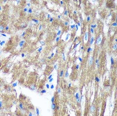 Immunohistochemistry-Paraffin: TIMMDC1 Antibody - Azide and BSA Free [NBP2-94234]
